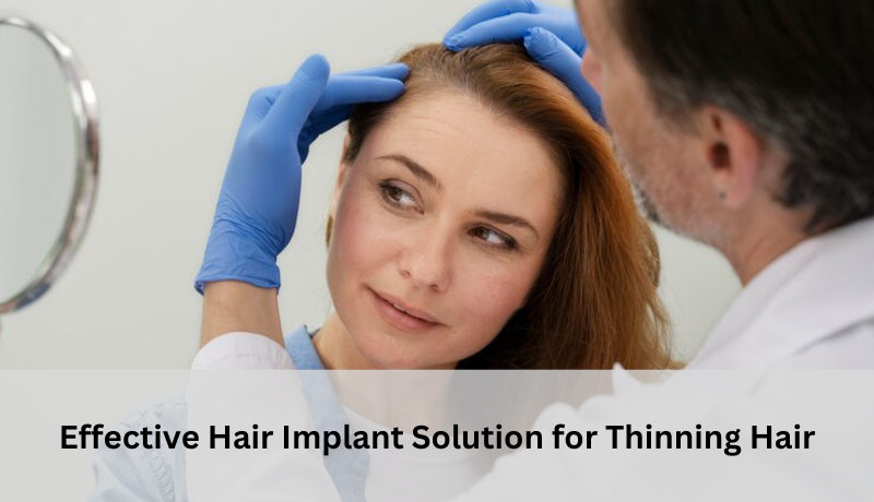 Effective Hair Implant Solution for Thinning Hair